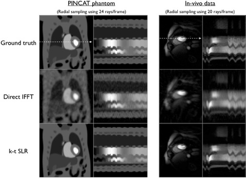 Screen shots of the reconstructions along with the image time series