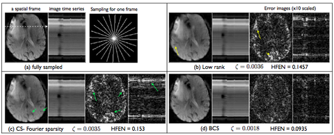 Result on brain perfusion MRI dataset