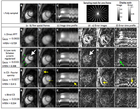 Myocardial perfusion MRI dataset