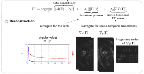 k-t SLR formulated as a spectral and sparsity regularized optimization problem