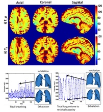 Learned image representations for multidimensional imaging