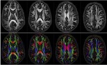 High Resolution Brain Connectivity Mapping