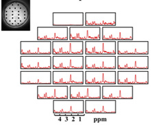 High resolution metabolic MRI using learned models